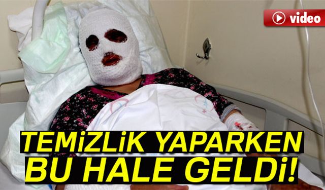 Evinde temizlik yaparken lavabo açıcıya sıcak su döken kadının yüzü feci şekilde yandı