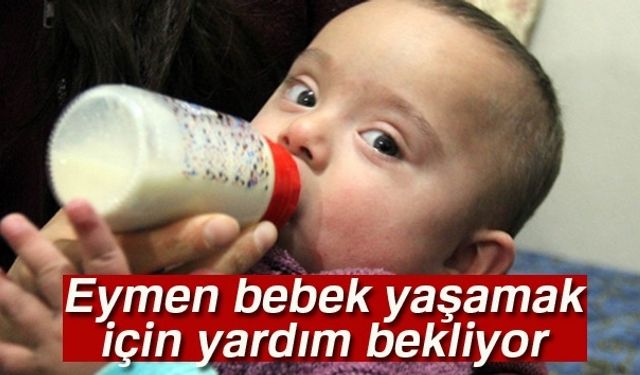 4 aylıkken geçirdiği ameliyat ile kalbindeki 3 delik kapatılan ve kalp kapakçığı değişen down sendromlu Eymen bebeğin ailesi, çocuklarının yaşaması için kendilerine uzanacak yardım elini bekliyor