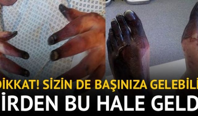 Sistemik skleroz adı verilen bağışıklık sistemi rahatsızlığı yüzünden kabusu yaşayan Andrew Shilliday, vücudunda döküntü şikayetiyle doktorun kapısını çaldı