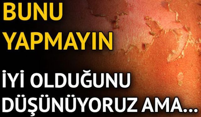 Cildinizi soymayın! Güneşlenip bronzlaştıktan sonra bir süre sonra cildimiz ölü deriyi atmaya başlıyor