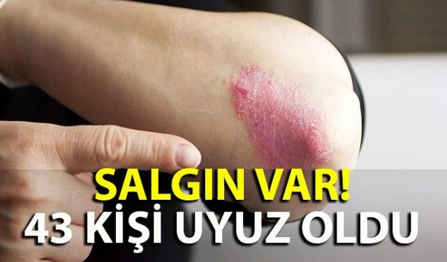 Salgın olduğuna yönelik çıkan dedikodulara cevap geldi