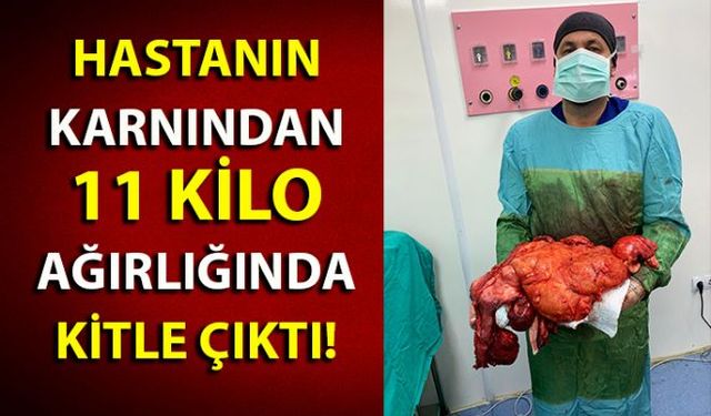 Zonguldaklı Selahattin Heper isimli vatandaşın karın şişliği şikayetiyle gittiği hastanede yapılan operasyonda karnından 11 kiloluk kitle çıktı