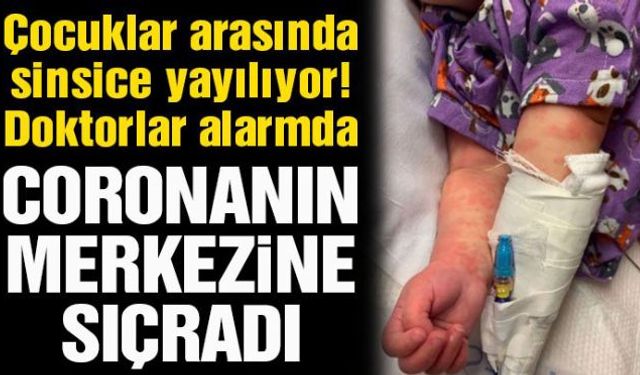 Corona virüsü salgınında çocuklar arasında yayılan toksik şok benzeri hastalık ABD'yi de alarma geçirdi