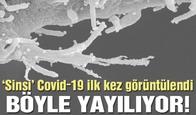 Dünya çapında 10 milyondan fazla insana bulaşan Covid-19 ile ilgili araştırmalar devam ederken California Üniversitesi'nde görevli uzmanlar, "sinsi" virüsün hücrelere nasıl zarar verdiğini ilk kez görüntüledi