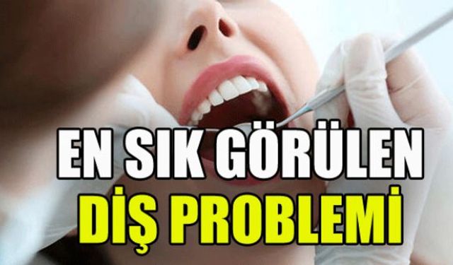 Herkesin doğru bildiği yanlışlar içinde bulunan ve toplumda en sık görülen diş problemi bakın neymiş?