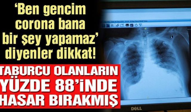 Salgın günlerinde birçok insanın aklından geçen, "Ben gencim/sağlıklıyım