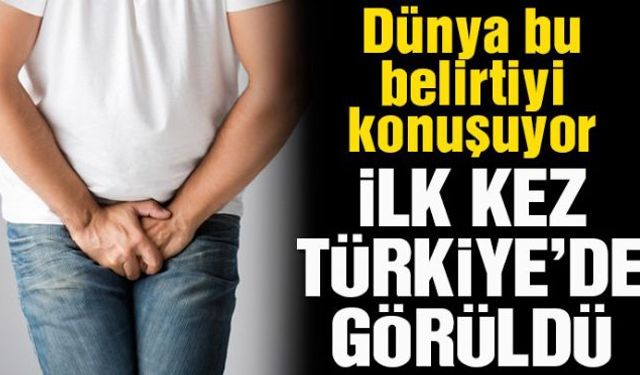 Corona virüsünde gün geçmiyor ki yeni bir belirti ortaya çıkmasın