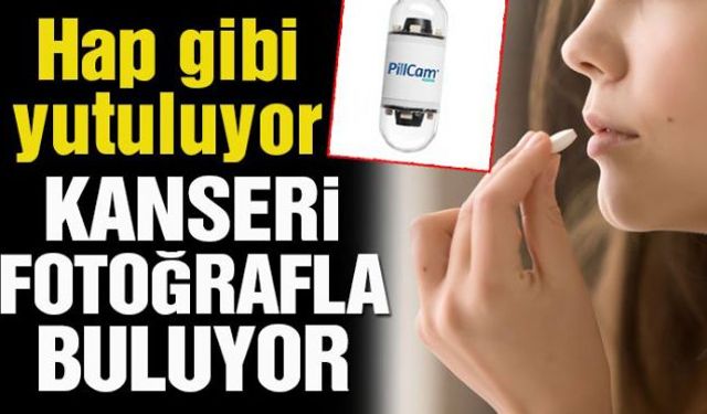 Corona teşhislere de darbe vurmuştu Hap gibi yutulacak kanseri fotoğraflayarak bulacak