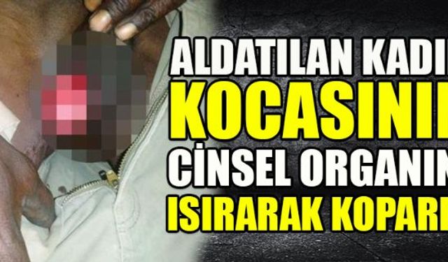 Başka bir kadınla aldatılan kadın, kocasının cinsel organını ısırarak kopardı