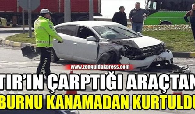 Kazayı burnu kanamadan atlattı